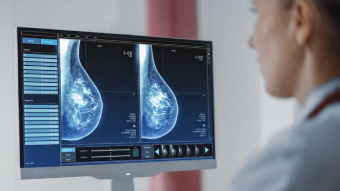 Computer Screen in Hospital Radiology Room: Beautiful Multiethni